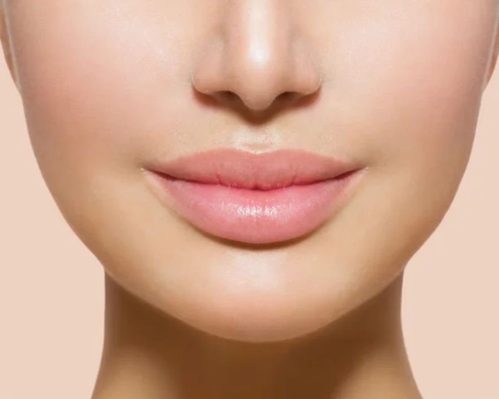 Dermal Fillers — Evolysse & Restylane